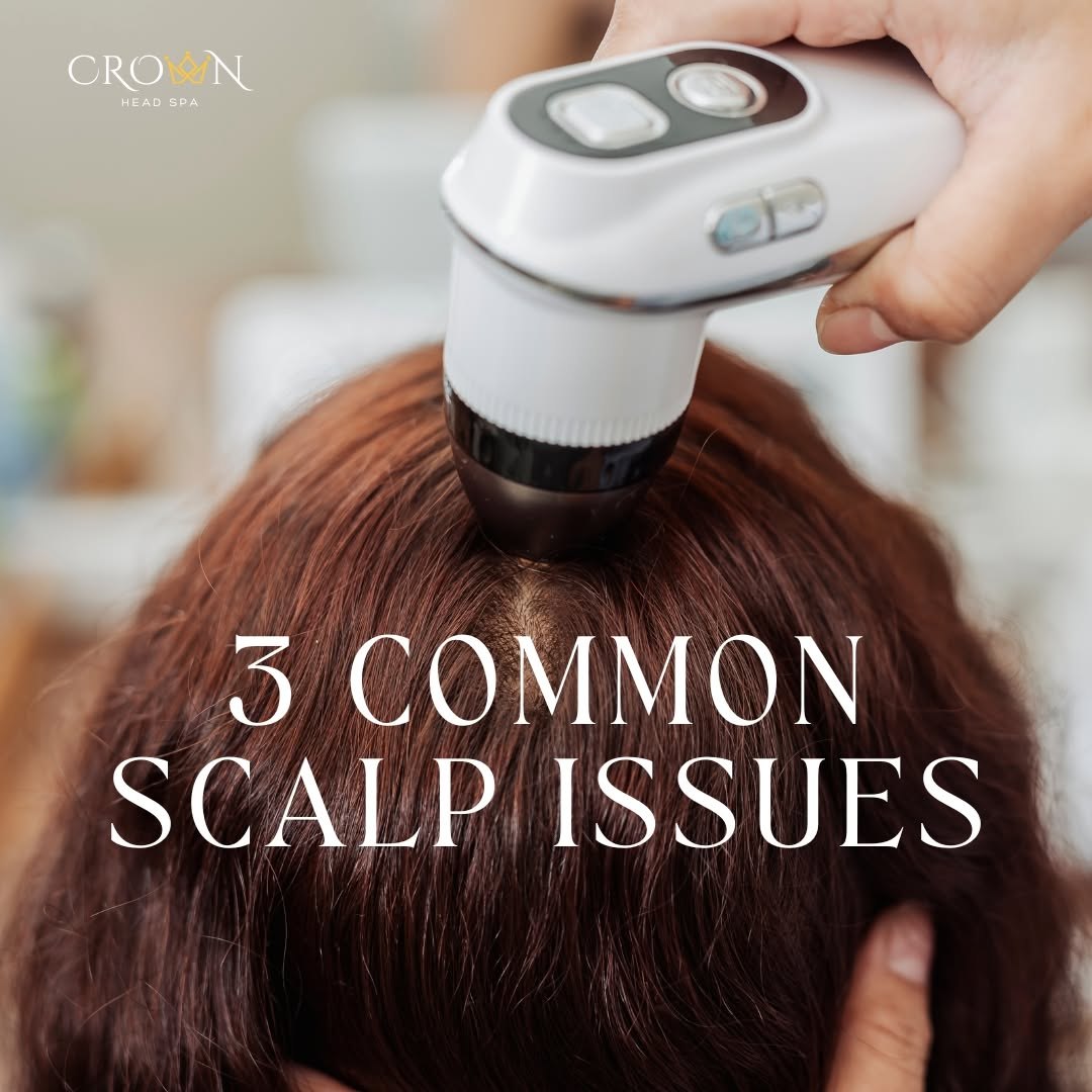 3 common scalp issues